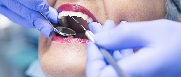 Best Emergency Dental Care for Broken or Chipped Teeth in Sheridan, CA